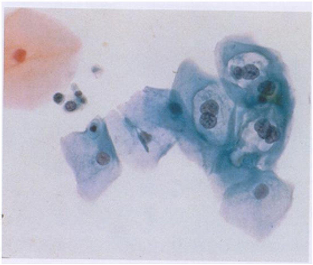 cervico1.jpg
