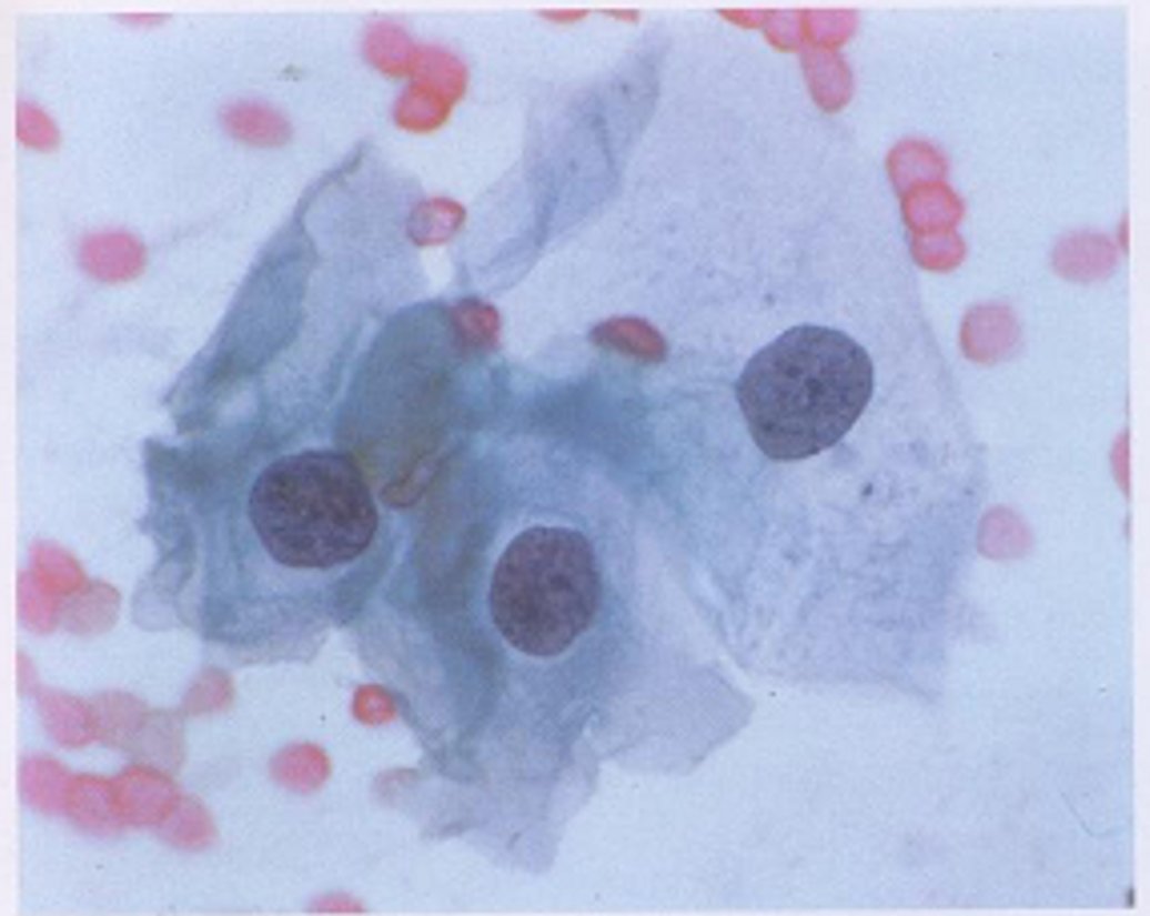 cervico10.jpg