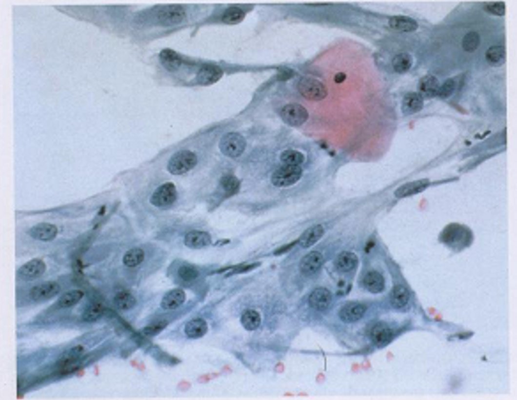 cervico2.jpg