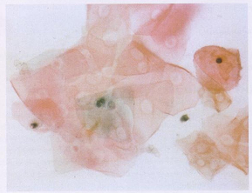 cervico3.jpg