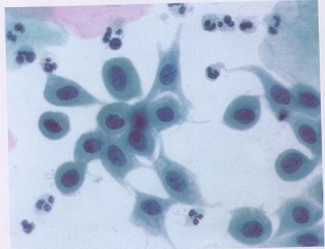 cervico4.jpg
