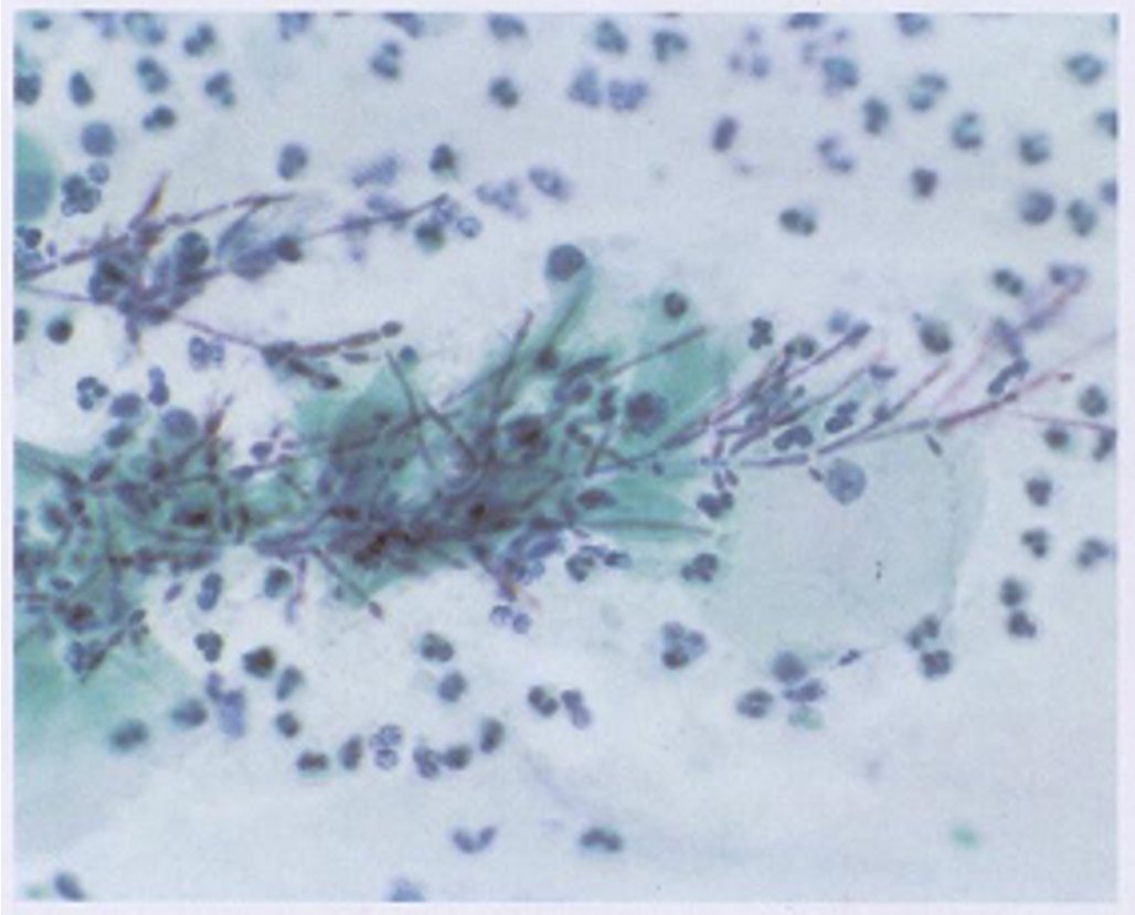 cervico5.jpg