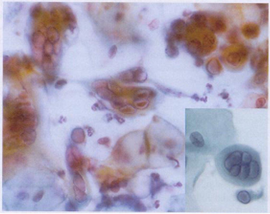 cervico6.jpg