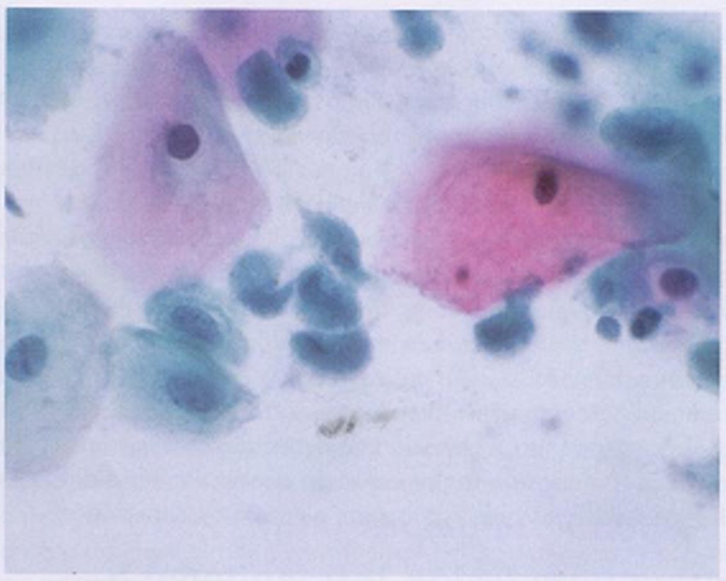 cervico7.jpg