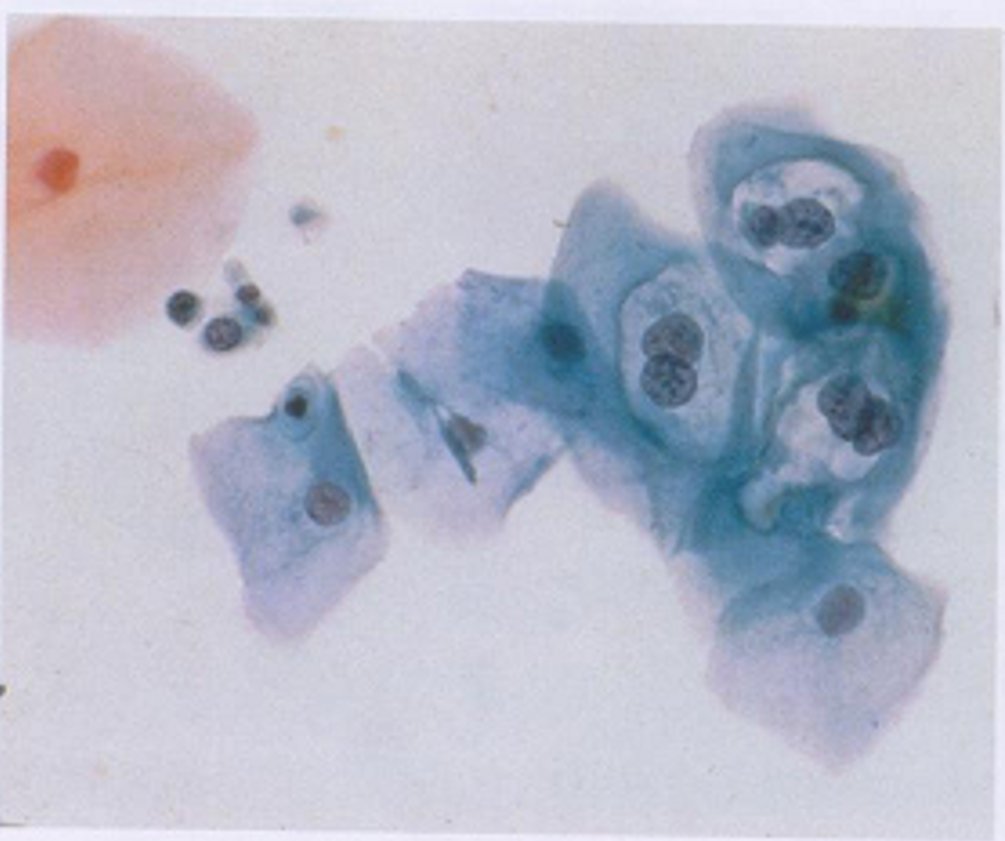 cervico8.jpg