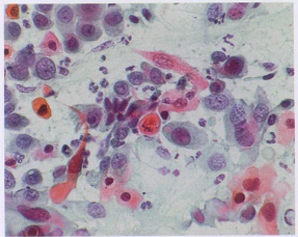 cervico9.jpg